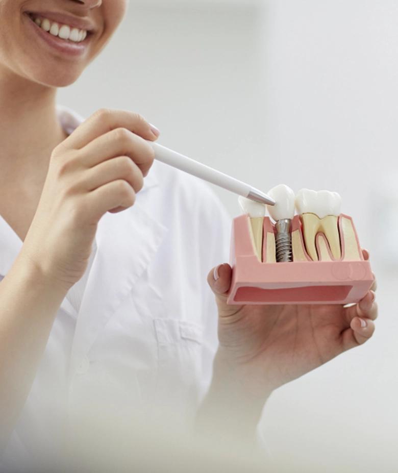 mujer señalando maqueta implante dental