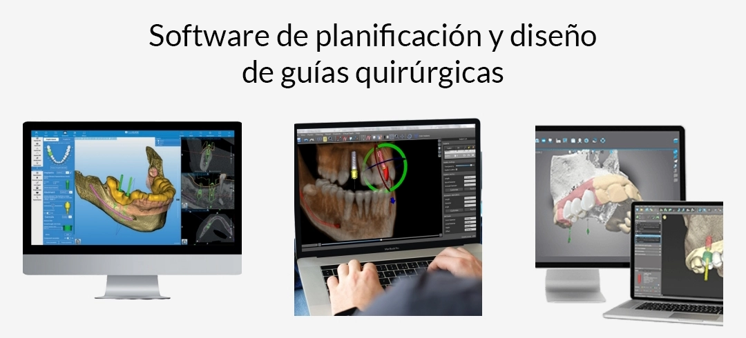 imágenes de ordenador para implantes dentales
